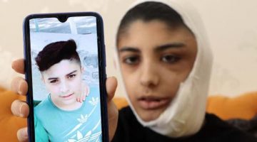 Hayatı kâbusa döndü! Her gün büyüyor