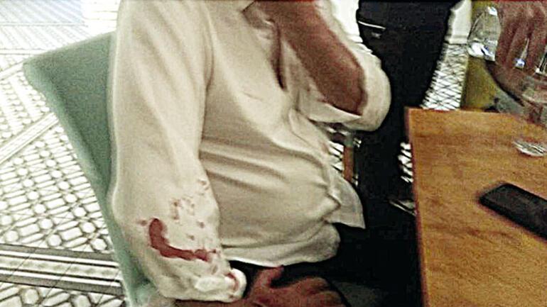 Başkana beyzbol sopalı saldırı